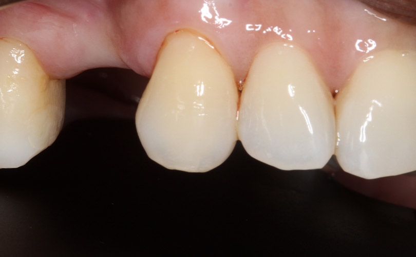 Before - Aventis dental