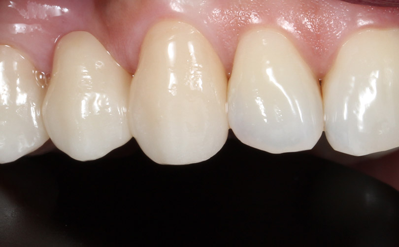 After - Aventis dental