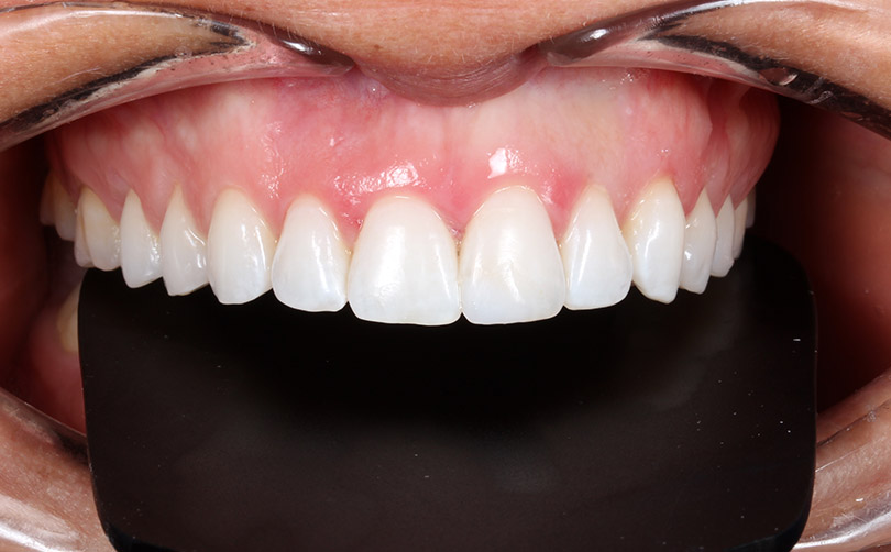 After - Aventis dental