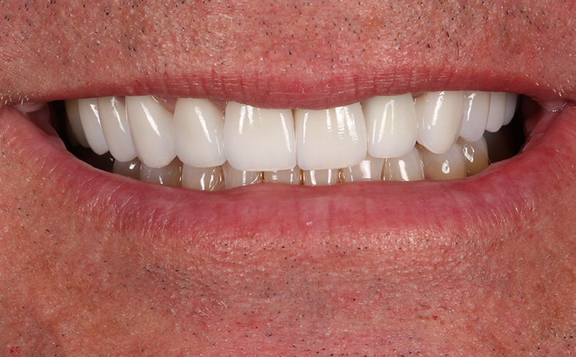 After - Aventis dental