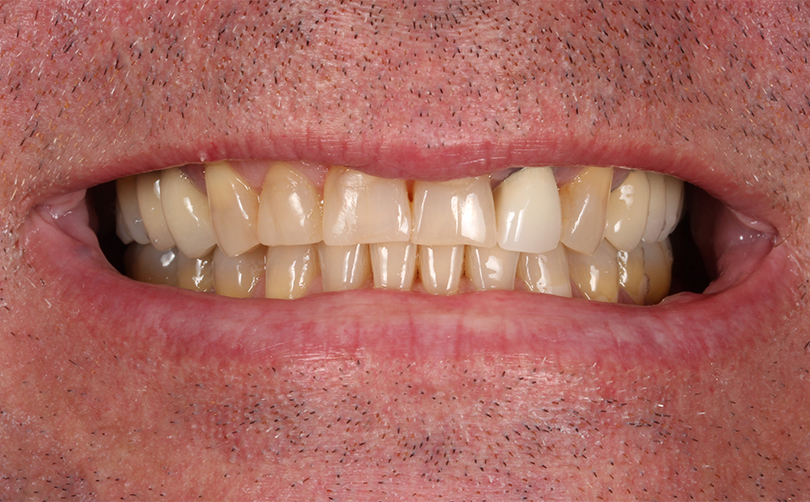 Before - Aventis dental