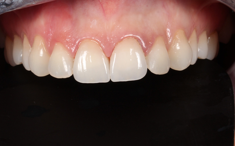 After - Aventis dental