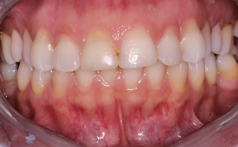 Before - Aventis dental