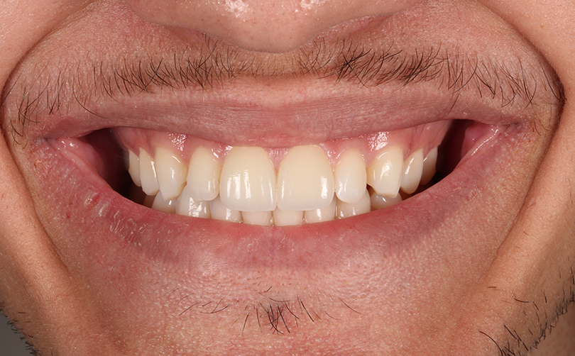 After - Aventis dental