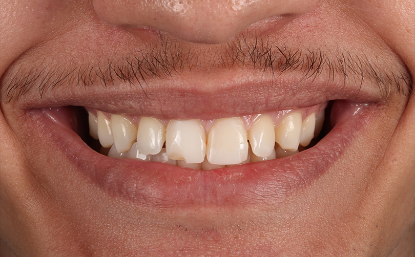 Before - Aventis dental