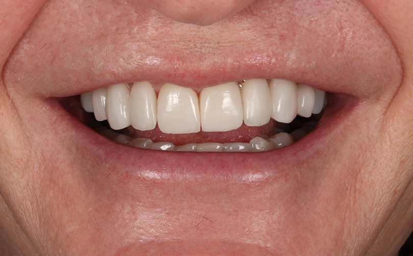 After - Aventis dental