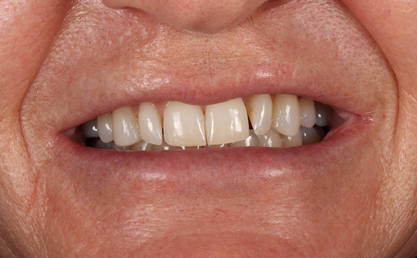 Before - Aventis dental