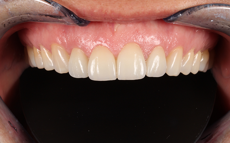 After - Aventis dental