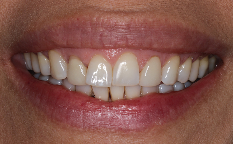 Before - Aventis dental