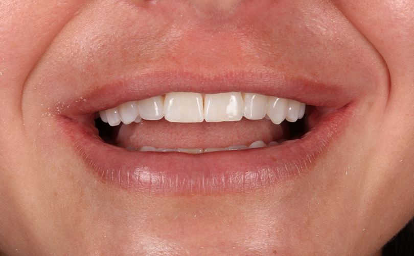 After - Aventis dental