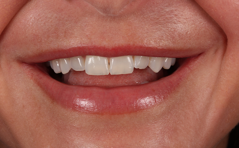 Before - Aventis dental