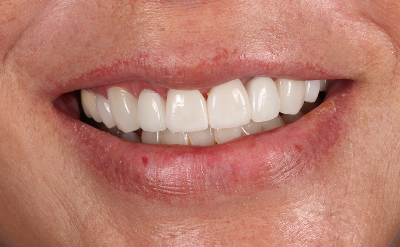 After - Aventis dental