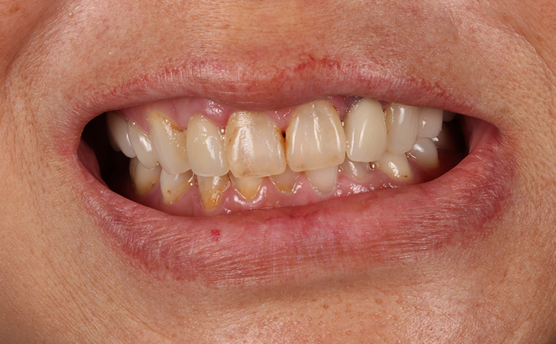 Before - Aventis dental