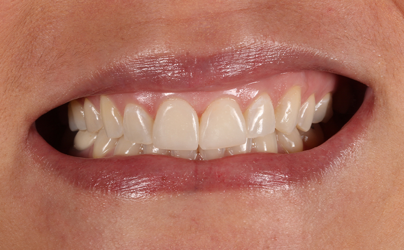 After - Aventis dental