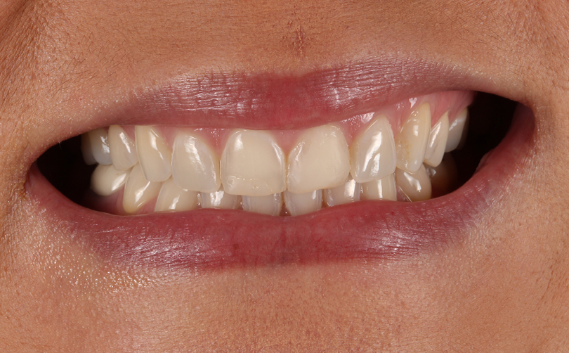 Before - Aventis dental